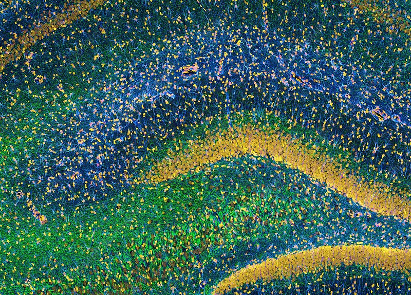 Hippocampus brain tissue (SciPhotoLib)