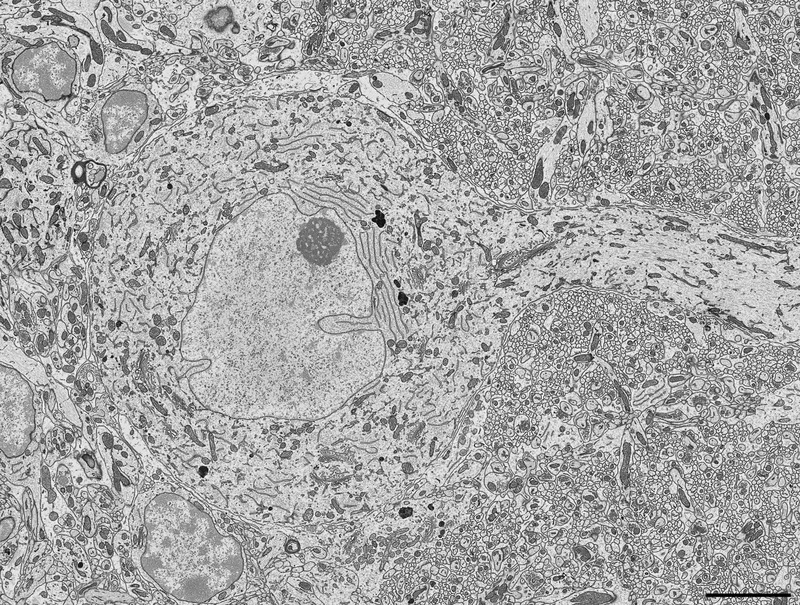 Purkinje Nerve cell, TEM (SciPhotoLib)