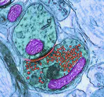 Aging and Aging-Related Diseases